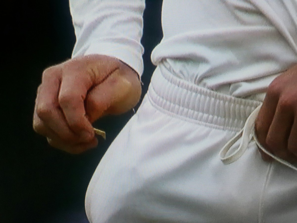 #SAvAUS what is in his hand???