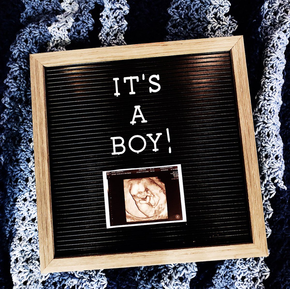 lqstrengthcoach's tweet photo. God’s Plan. We are excited to announce that come September we are expecting a baby boy as the newest addition to the Quinn family... We couldn’t be happier 😊👶🏻 @samantharaequinn is going to be the best mom in the world. https://t.co/1xH0bi1JVP