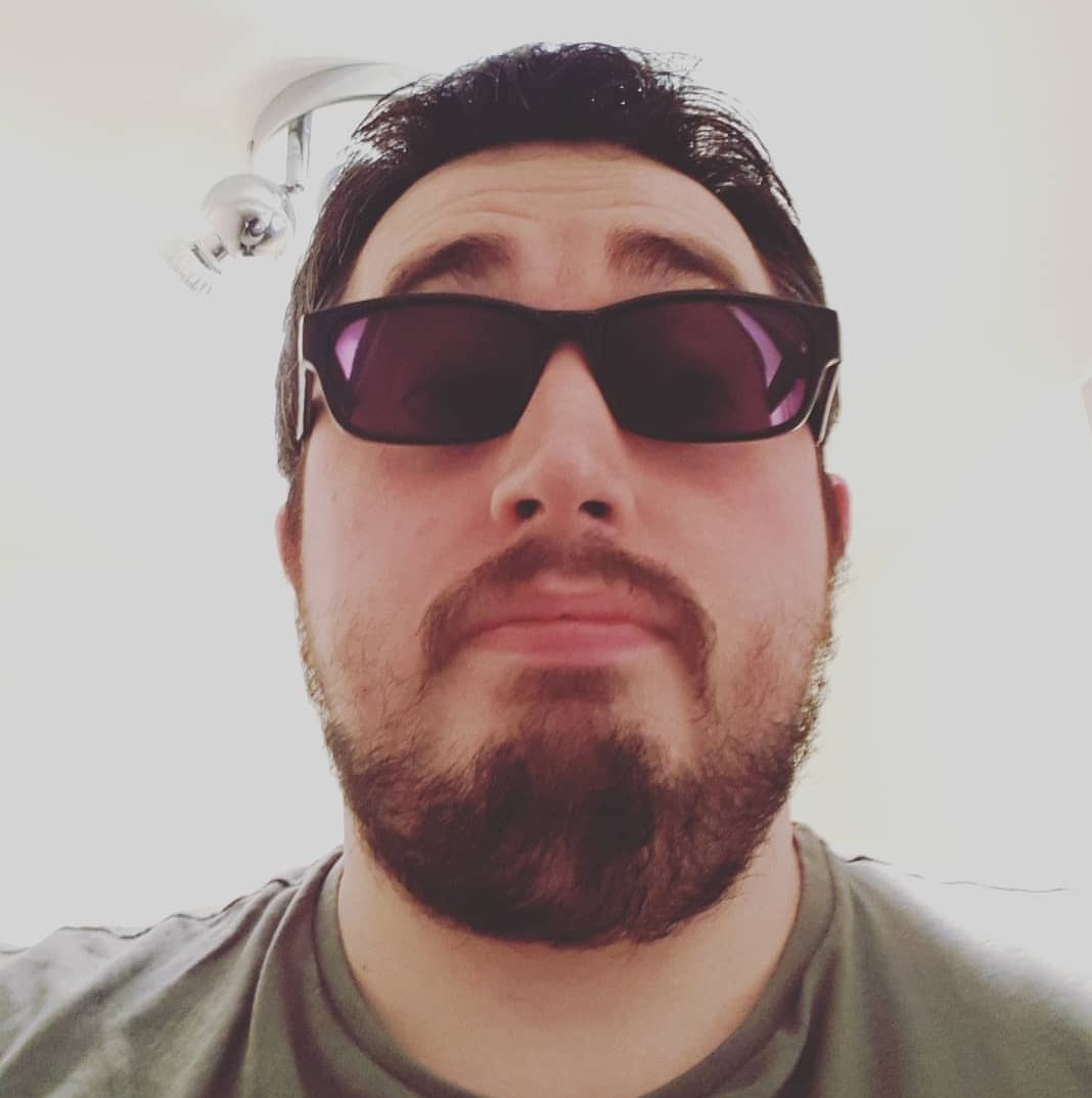 afamck's tweet image. When the #kerataconus hits you hard #livingWithKc #lightSensitive