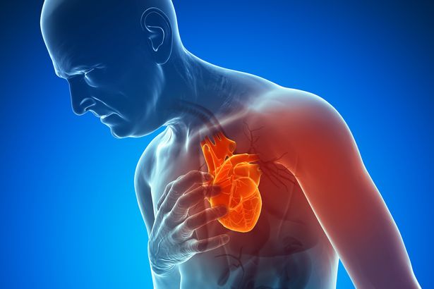 Canadian_Stats's tweet photo. Heart attacks are due to coronary artery disease. This disease is caused by atherosclerosis because it affects the arteries that supply blood to the heart.
Strokes are due to atherosclerosis because it affects the arteries that supply blood to the brain. https://t.co/knoPtejuCA