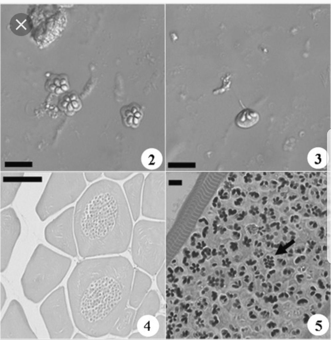 A chance discovery of a new #Parasite species in a 2004 undergraduate field class started my career as a #systematist . Isn't Kudoa monodactyli, my first species cute!?! Show me the first species you described.. #newspecies #myxozoa #fishparasite #notabeetle