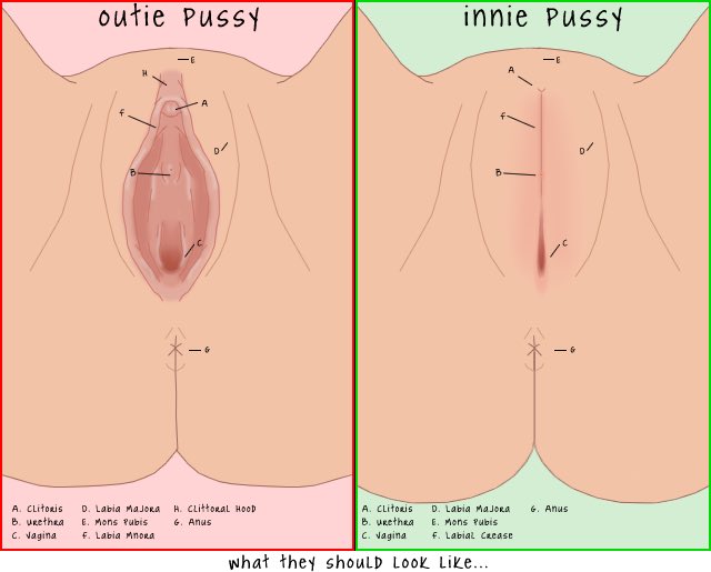 difference between innie and outie labia