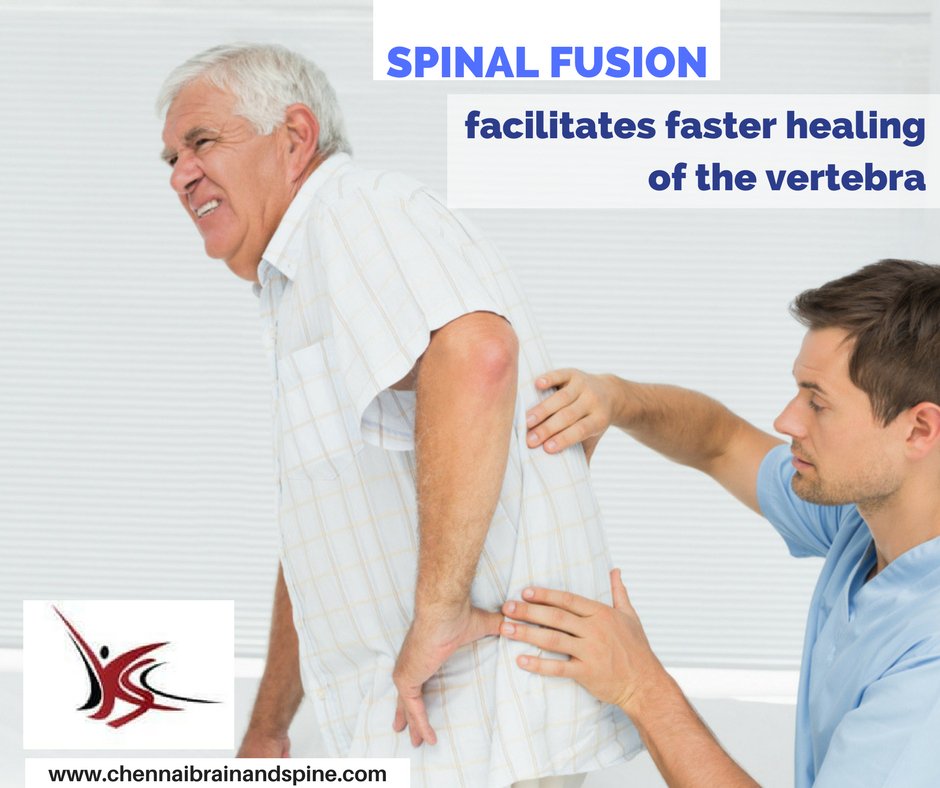 chennaibrainan2's tweet image. Know more about #Spinal_fusion.
Visit now: chennaibrainandspine.com/spinal-fusion.…
#Spinal_treatment #Spinal_disorder 
#Chennai