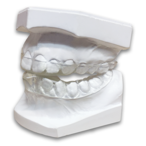 Do you suffer from teeth grinding, chronic migraines or even #Bruxism?

GPs will likely prescribe you painkillers, which aren't a permanent solution. Visit your dentist for an SCi, to stop teeth grinding and migraines. 

For more info:
chequersds.com/anti-grinding-…