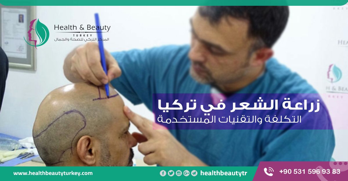 #زراعة_الشعر في تركيا في المركز التركي للصحة والجمال
goo.gl/ue22HT
.
لمزيد من المعلومات يمكنكم التواصل عبر:
انقر الان للتواصل مع المرشد الطبي عبر واتساب 
goo.gl/P1qiTF
أو اتصال على الرقم 
Tel,Viber: 00905315969383
أو عبر موقعنا:
healthbeautyturkey.com