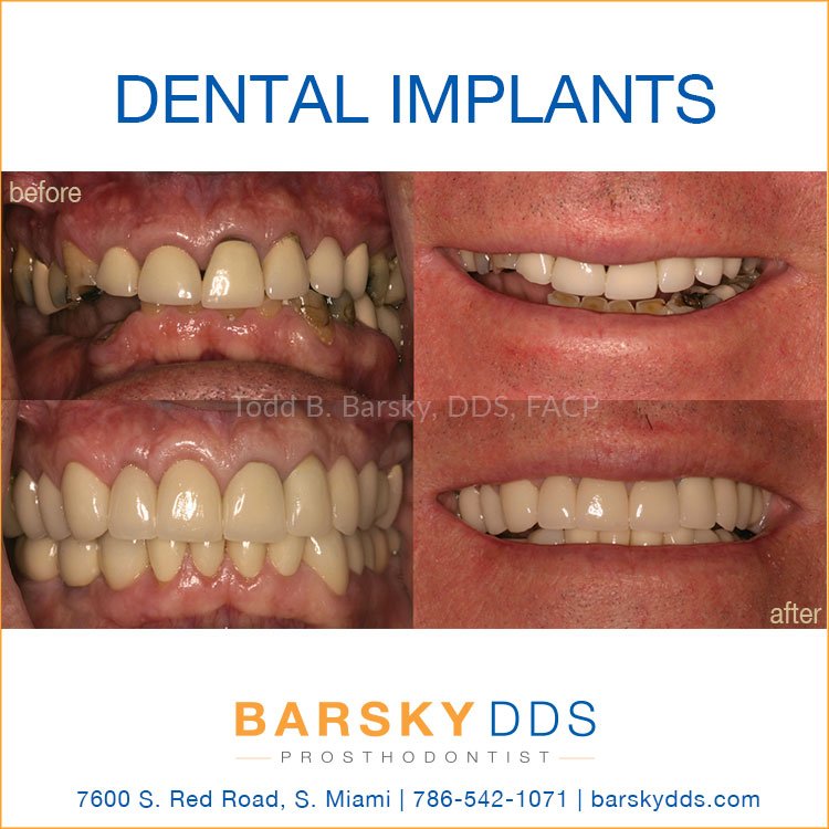 Todd Barsky DDS (@BarskyDDS) / Posts / X