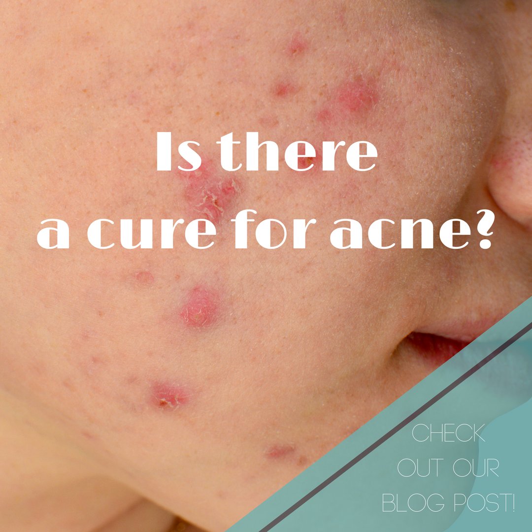 Barely_ThereSC's tweet photo. Is there a cure for acne? Click here to read my blog post! https://t.co/zeSpW43JlJ https://t.co/i6KL8kaU8w