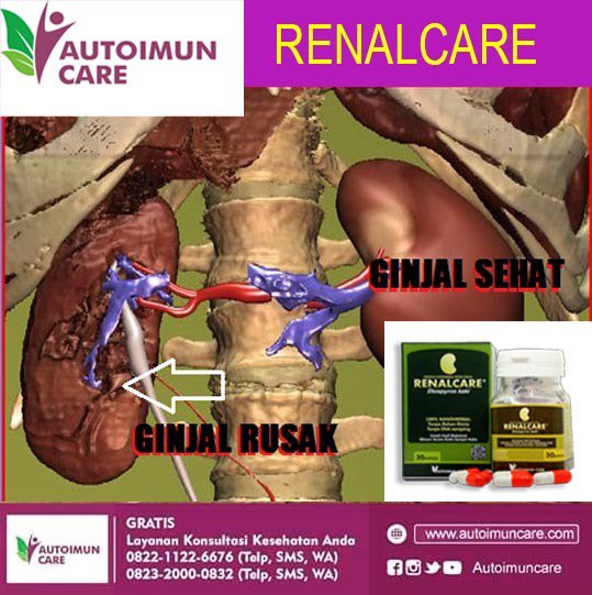 Download 84 Gambar Ginjal Sehat Dan Rusak  Gratis HD