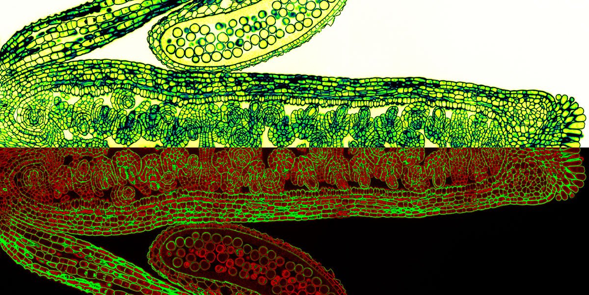 INRAE_Intl's tweet image. #sneak_a_peek: organisation of ovules in the #pistil of Arabidopsis thaliana #photo #microscopy #INRA KBelcram. 
Crossing over with Raphaël Mercier: the mechanics of #meiosis url.inra.fr/2cf2ndL 
(Follow us: instagr.am/inra_france )