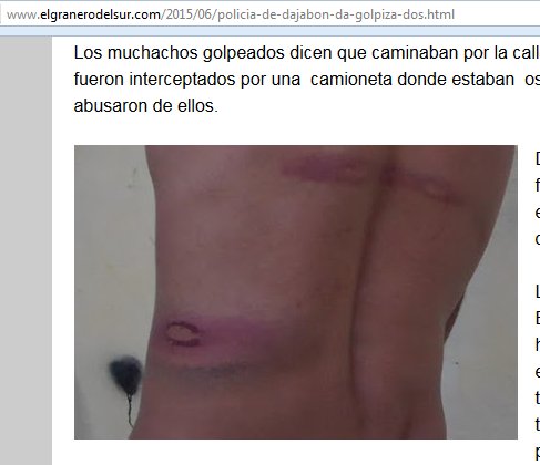 Una ayuda para este pobre desgraciado que tiene al abuelo muriéndose, la madre enferma y un hijo dependiente. Y encima tiene que robar las fotos de sus lesiones. Por caridá.