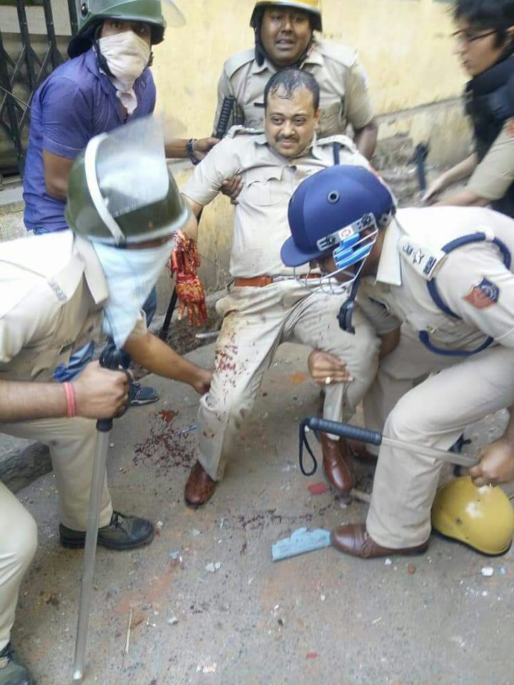 It pains to see this and brings to fore perils and tough situations that police face. 

Asansol-Durgapur DCP & IPS officer Arindam Dutta Chowdhury was severely injured & lost his hand in abhorring violence on Monday. We pray for his speedy recovery and full restoration of hand.
