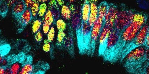 TheScientistLLC's tweet photo. #ImageOfTheDay: Knocking out a single gene can change the developmental fate of tumor cells in mice, causing stomach cells to develop within lung tumors. #NSCLC #cancer #devobio https://t.co/wYgXvMwi65 https://t.co/mbxliuHMEK