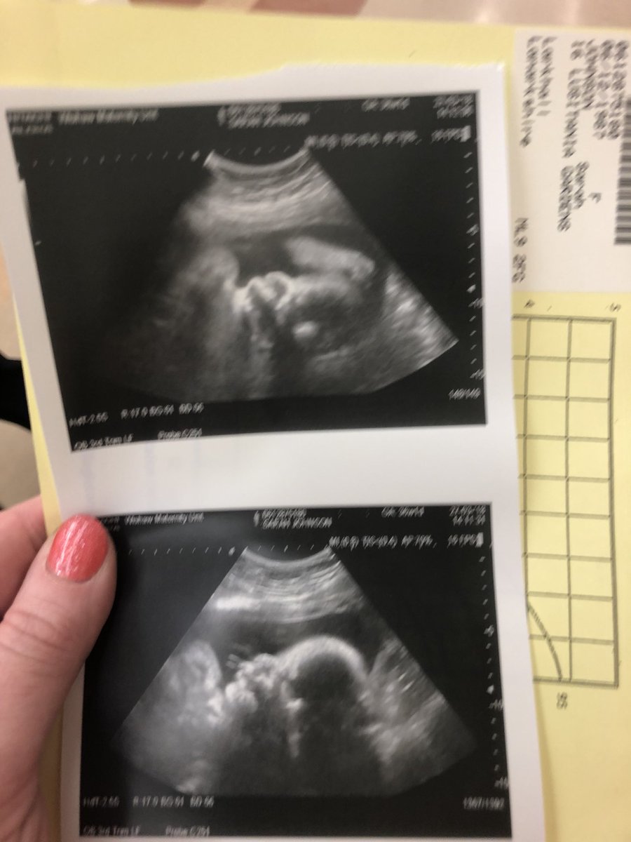 Sarah Johnson tweet media