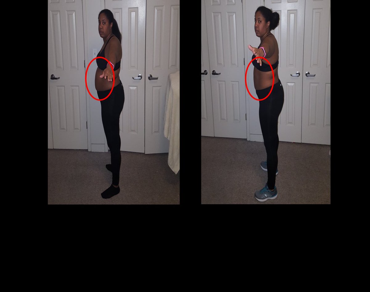 LatrealMitchell's tweet photo. I'm so proud of @rashilag who is 1 week in on her 6 week program and the progress has begun. Keep up the great work! This is a working mom with twins making it happen. πͺπ½β€ #NoExcuses #BodyBlitz365 #CleanEating #TransformationTuesday #HealhtyLifestyle #LatrealMitchell #LaTips https://t.co/wQUkV20oy2