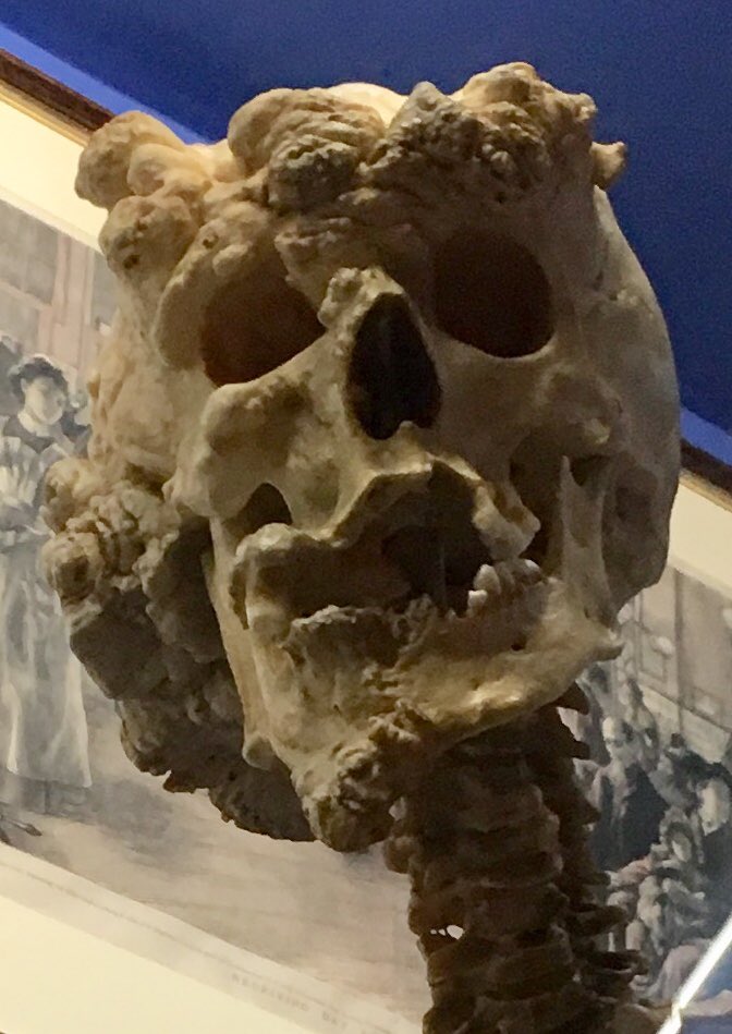 jblackauthor's tweet photo. The Elephant Man says hi
Today at the Royal London Hospital Museum
#senseofplace #davidlynch #regkray #englishmythology https://t.co/qmLsv5rqhO
