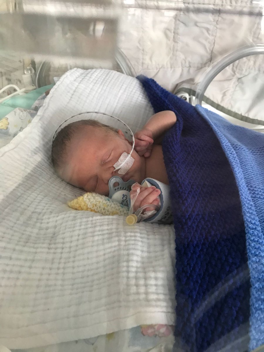keb020186's tweet photo. ❤️ My beautiful boy James born at 34 weeks  ❤️ https://t.co/yfGdYSLm8n