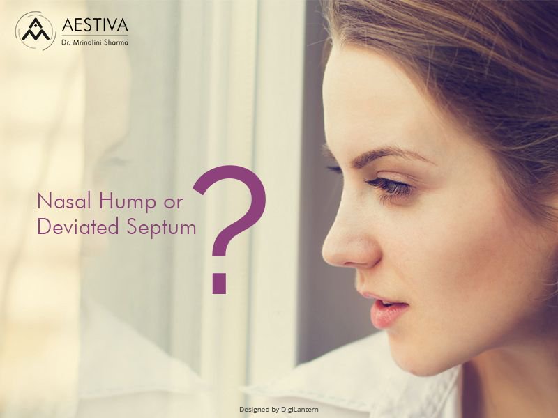 #Rhinoplasty is the answer to all your nose problems and helps to give you a perfect #noseshape that can elevate your overall appearance by making your features look more balanced.
For more information log on to - buff.ly/2Ge8P7u or call us at +91-844-765-2698.