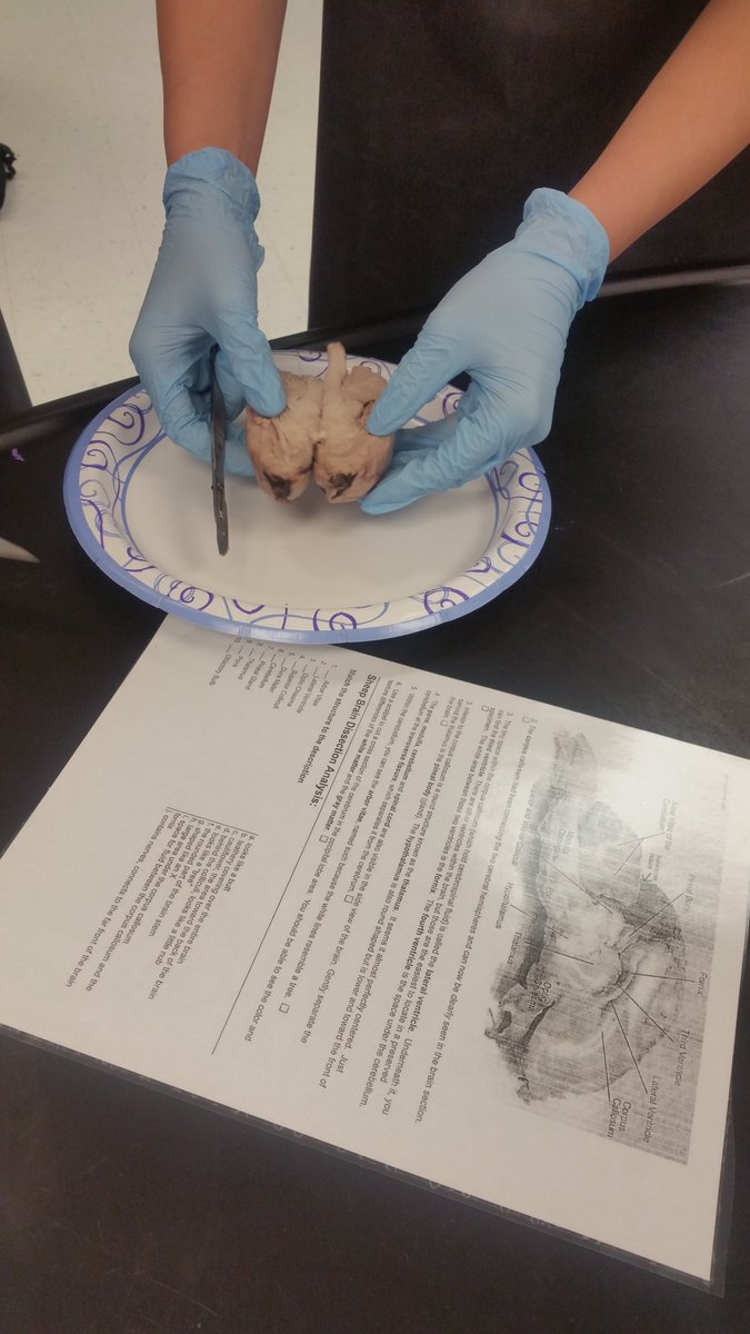 krob5570's tweet photo. Sheep brain dissection in Honors Anatomy #ahsengagement https://t.co/31tSfVTyNA