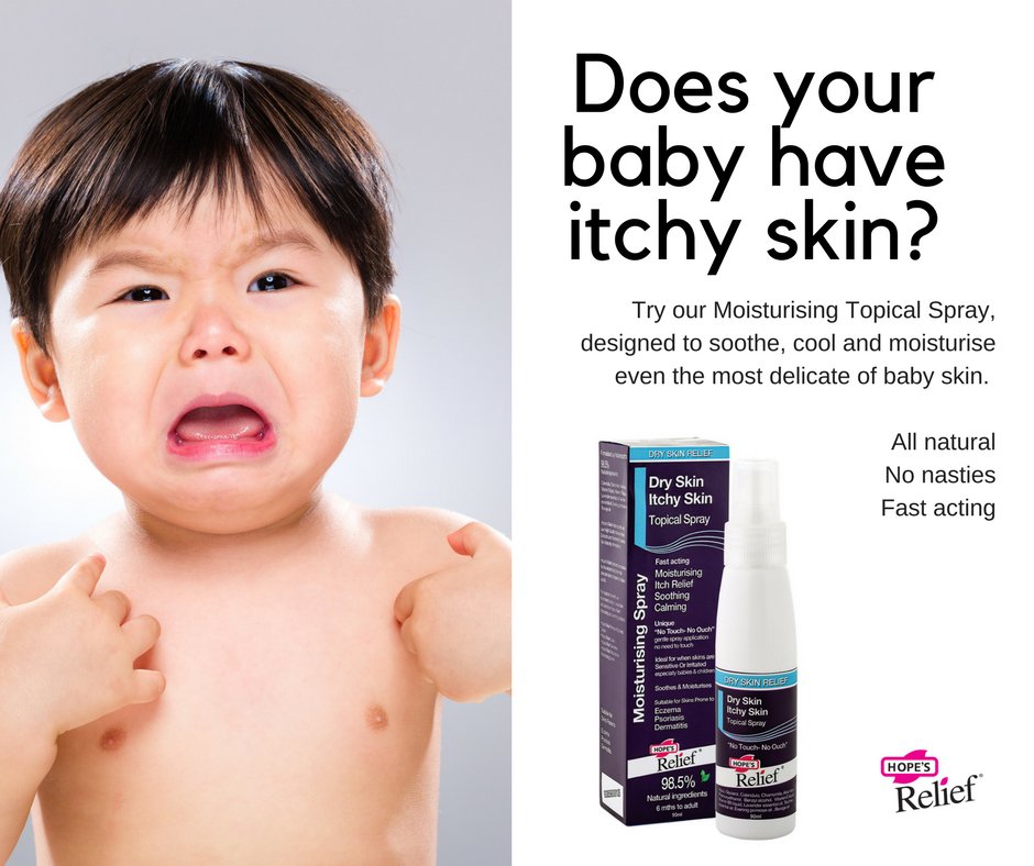 HopesReliefUK's tweet photo. Our all natural 'No Touch No Ouch' Topical Spray soothes your baby's skin, with the liquid helping to speed up the skin's healing process. Get it here: https://t.co/WIzJMN9sBf #eczemarelief #hopesrelief #topicalspray https://t.co/ADiLMWR9e9
