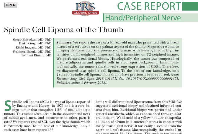 AraSalibianMD's tweet photo. #PRSGlobalOpen—See how #plasticsurgeons treat a case of #spindlecell #lipoma of the thumb in this article :https://t.co/Dm9qs2M7Zj
#PlasticSugery @prsjournal #handsurgery https://t.co/lzCau1yEKc