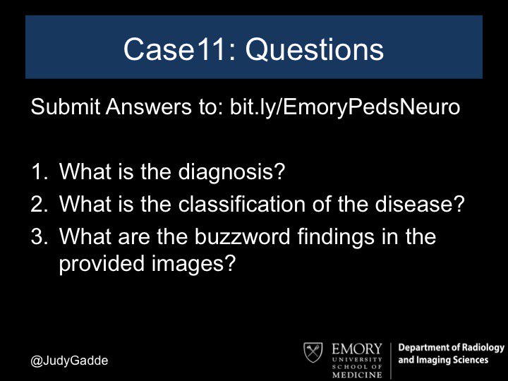 Emory Peds Neuro Case #11
History: Young male with progressive motor and cognitive decline

Submit answers to: bit.ly/EmoryPedsNeuro        
Answer posted as reply in approximately 48 hours.

#FOAMRad #FOAMed #EmoryPedsNeuro #PediNeuroRads #Pedsneuro #EmoryRadiology #SoMe