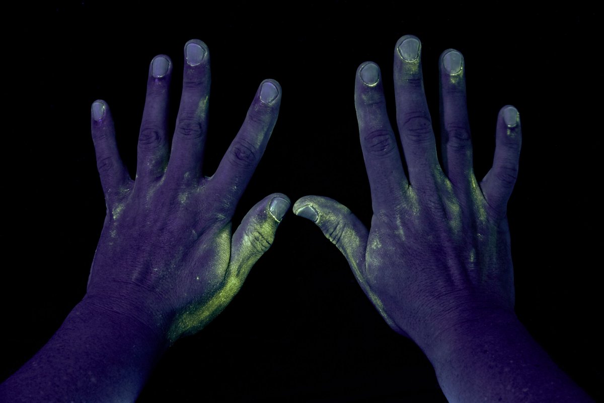 Look at how dirty these hands are! These are the hands of someone who doesn't wash and dry them properly. If you #LoveYourLenses, wash and dry before touching your eye!