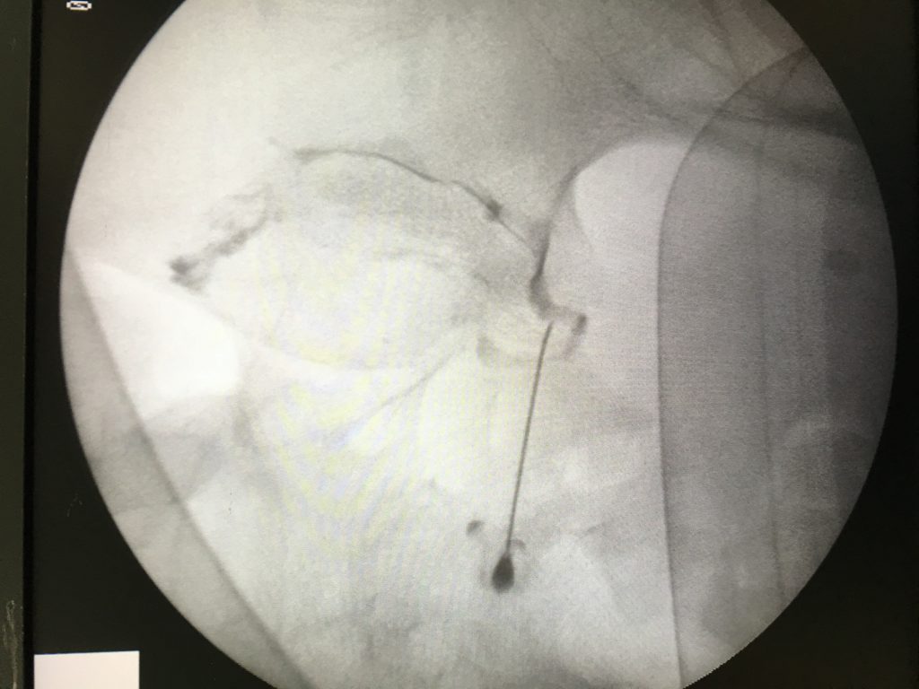 ¿Sabes cómo mejorar tu calidad de vida? Nosotros te lo explicamos. dolortarragona.com/como-mejorar-t…