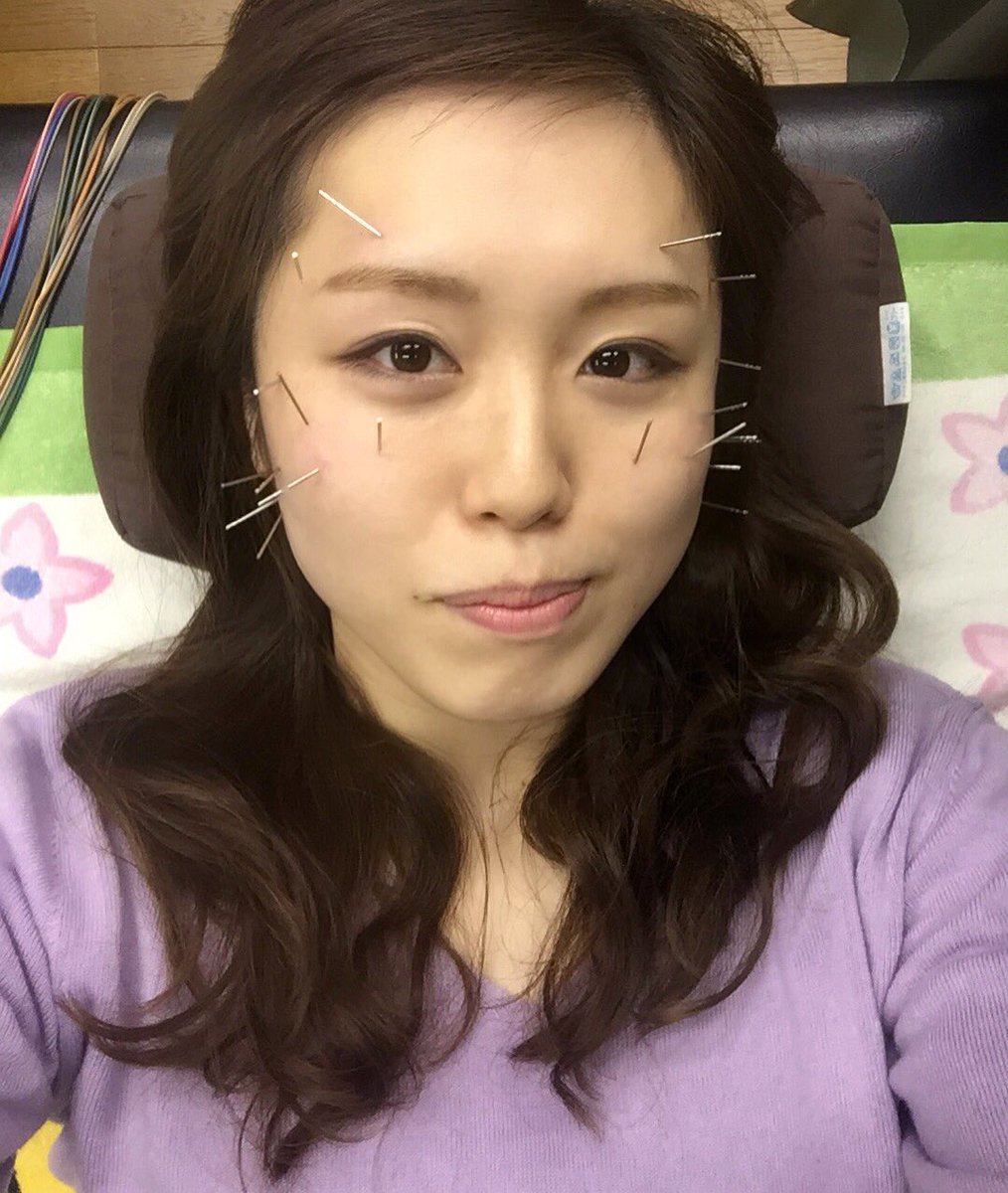 谷山佳菜子 美容鍼してもらいました 練習 治療 美容鍼 食事とお世話になりっぱなしの一日 木俣先生ありがとうございました M M 美容鍼 昭栄接骨院 寝屋川 木俣先生 キックボクシング女子 空手女子 谷山佳菜子 昭栄接骨院 T Co 谷山佳菜子 美容鍼してもらいました 練習 治療 美容鍼 食事とお世話になりっぱなしの一日 木俣先生ありがとうございました M M 美容鍼 昭栄接骨院 寝屋川 木俣先生 キックボクシング女子 空手女子 谷山佳菜子 昭栄接骨院 T Co