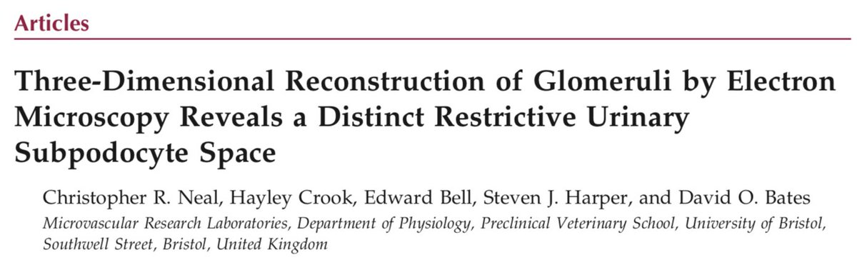My favorite study of all time. Packed full of data. Have read it 4 times and discovered something new each time. Buried within is an interesting / outlandish explanation for how the podocyte VEGF can reach the endothelial cell. Can you find it?

jasn.asnjournals.org/content/16/5/1…