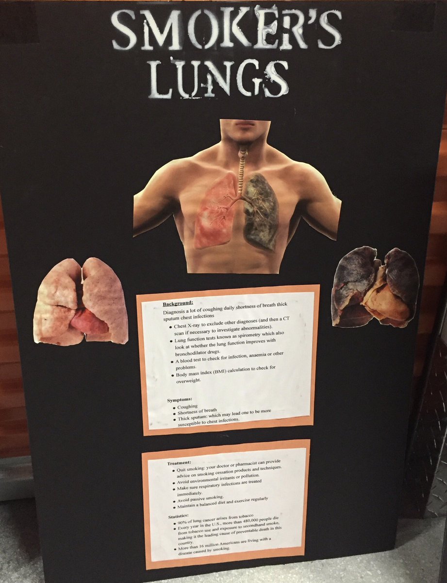 PhiDE_FLalpha's tweet photo. SNEAK PEAK FOR TOMORROW!! Check out some of the diseases our models will be demonstrating tomorrow! It’s definitely something you don’t want to miss! And...of course...there will be treats!💉💜 #PhiDE2018 #diseases #bodyexhibit #FIU https://t.co/QIMy9Ev3hV