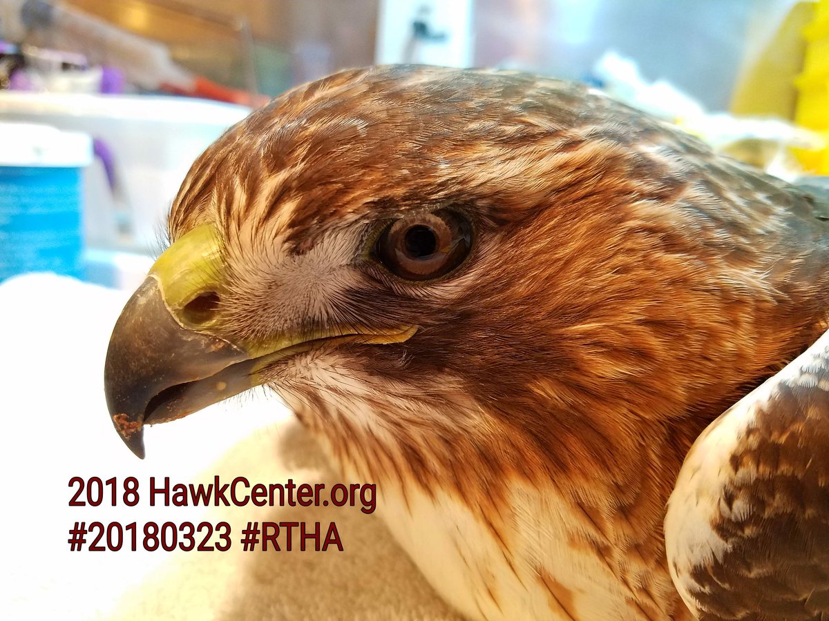 #20180323 is an adult male #RedTailedHawk brought to us by @arkansasgameandfish after it was found snared in a #SteelJawTrap . He lost one of his digits, which was necrotic, but still attached. 

 #FingersCrossed #HawkCenter2018