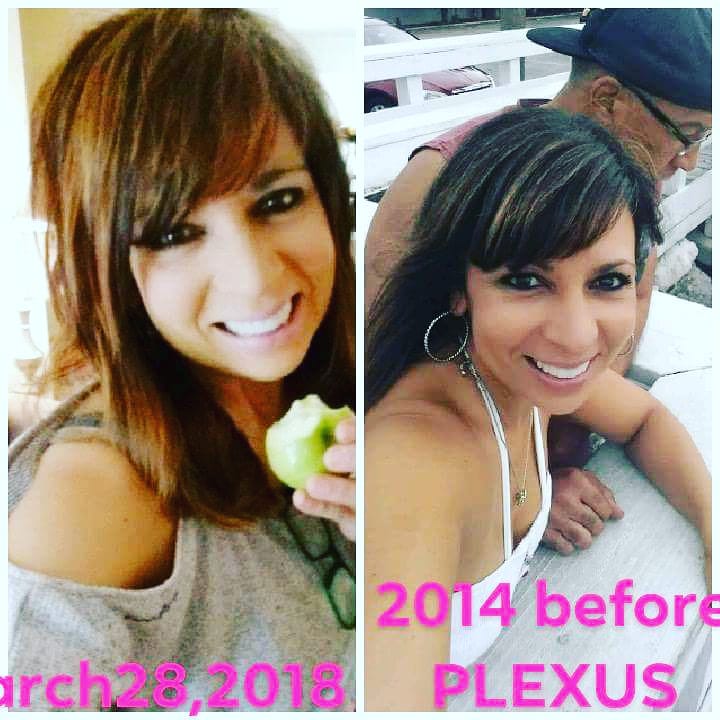 emb1917's tweet image. 😎 

Ever wondered why Plexus people have a {{GLOW}} or look younger 👱🏽‍♀️than they are??? It's #BIOCLEANSE!! Plexus BioCleanse contains magnesium which produces proteins that are transformed into collagen!

#Skincare
#biocleanse#plexus#agedefying
#collagen
