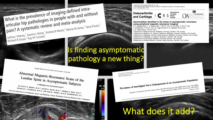 mskultrasound's tweet image. Looking forward and honoured to be presenting at the Danish Physiotherapy Conference in April. A complex and challenging area of clinical practice currently,critical evaluation and a balanced approach important. #holistic #patientcentred #keepitrelevant