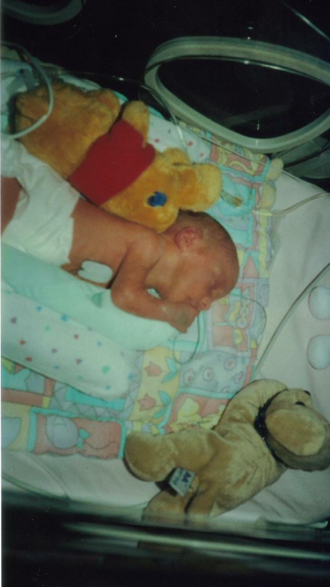 KirsteenCampbel's tweet photo. My wee premmie is 16 today #prematurebaby #SweetSixteen #allgrownup #mygirl #dartsdaft #celticdaft https://t.co/fNzrhAZT8m