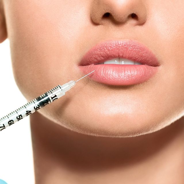 sculptindia Redefine your beautiful #LipShape with #DermalFillers injection in Delhi. An amazing procedure to enhance your gorgeous look.