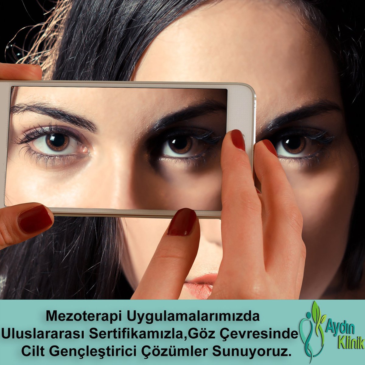 Uluslararası Mezoterapi Uygulama Sertifikamızla, göz çevrenizde oluşan, kırışıklıklar, göz altı torbaları ve göz kapağı sarkmalarında operasyonsuz çözümler sunuyoruz. #mezoterapi #gözaltıtorbaları #gözçevresikırışıklıkları #AydınKlinik #DrEsraYelkenciAydın aydinklinik.com/mezoterapi