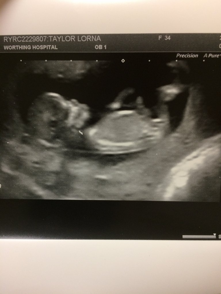 New post up as we share our news....mytaylormadeblogs.com/2018/03/29/tin… #parenting #pbloggers