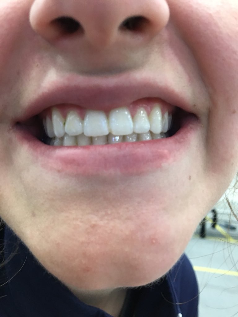 karleebrennan_'s tweet image. HAPPY BIRTHDAY KATE! Thank you for always letting me talk to you and always being there for me. You’re a model. Love ya girly! #toothpic