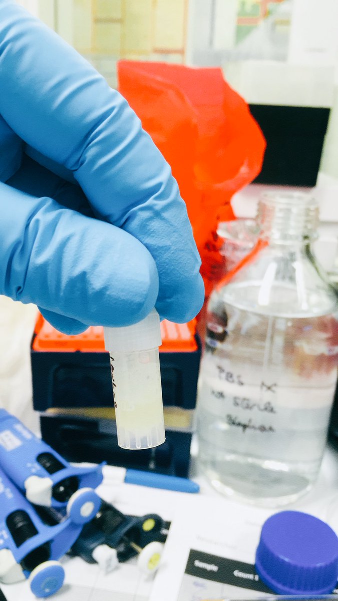 SBerneau's tweet photo. Another day in the lab counting spermatozoa using the haemocytometer 💁🏻♂️🔬#TeamSperm #research @louise_waddy @DrM_carroll @M_Tovs https://t.co/HupTZXOz77