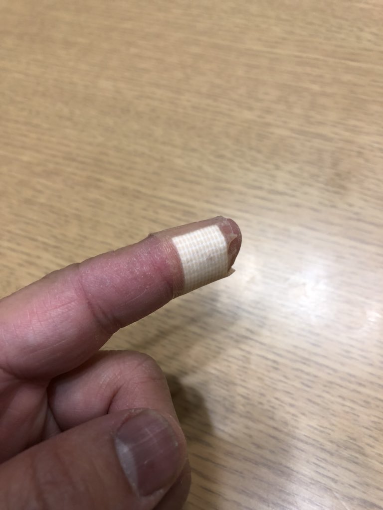 0 59studio お大事に ほんと 指先 はきついですね 私もこないだデザインナイフで切って結構不便でした それがまた 年取るとなかなか治らないんですよ