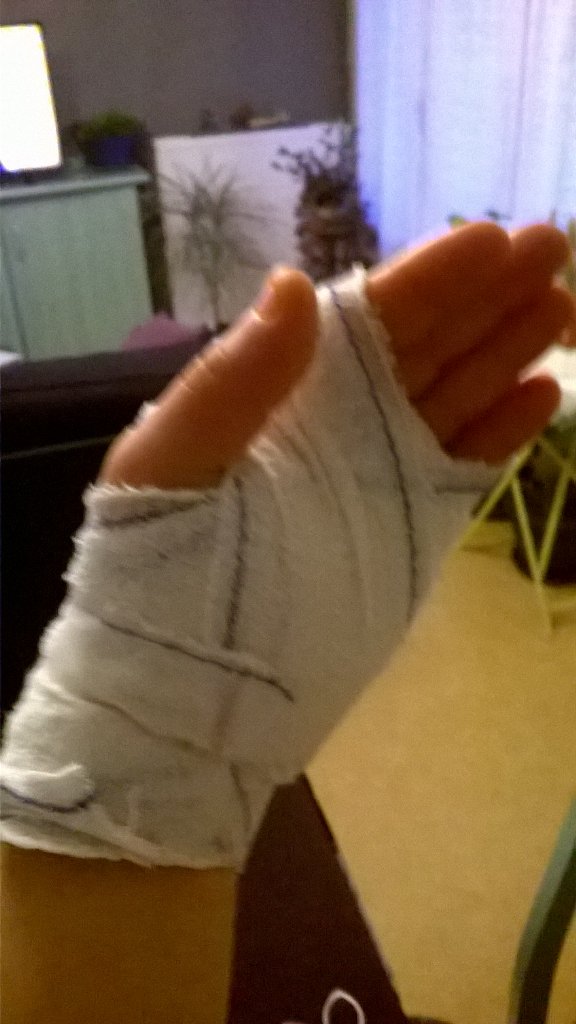 ellessors's tweet image. Petite opération. Canal carpien.. Mtn soins convalescence..