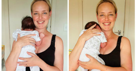 fitpregnancy's tweet photo. Nutritionist Shares Her 'Real' Postpartum Body https://t.co/L0TXLms490 https://t.co/aR4TULXBPh