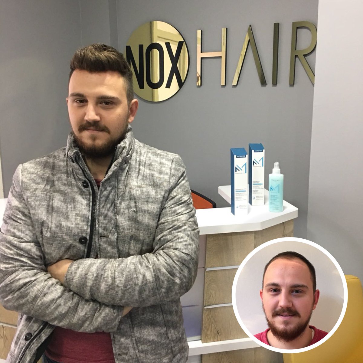 Nox Hair Protez Sac Merkezi On Twitter Protezsac Protezsacbakimi Protezsac Protezsacnedir Protezsacyapanfirmalar Noxhair Noxhairprotezsacmerkezi Noxhairprotezsac Kaliteliprotezsac Protezsacbakimlari Protezsacbakiminasilyapilir