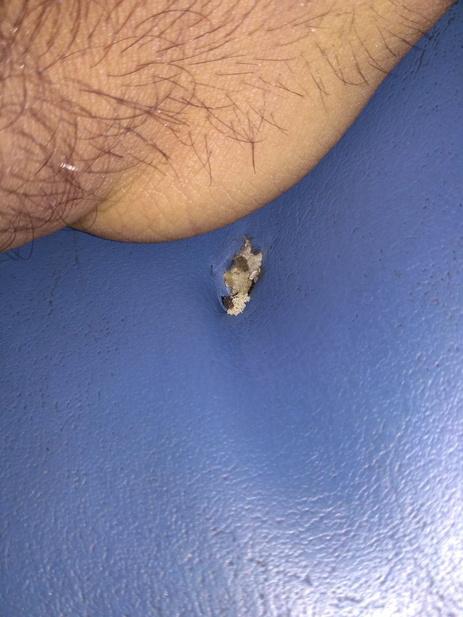 harpreet9497's tweet photo. The condition of my birth is not managable, the seat has a lot of spines coming up that it is been hurting me since morning. 
Travelling in Yesvantpur SF Express pnr 4143135969.
Please provide solution as soon as possible.
@RailMinIndia @RailwaySeva @PiyushGoyal https://t.co/ykQGAwMTMI