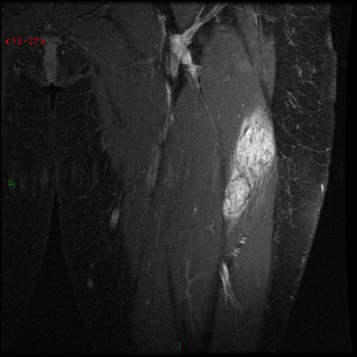 Rochester General Hospital IR tweet media