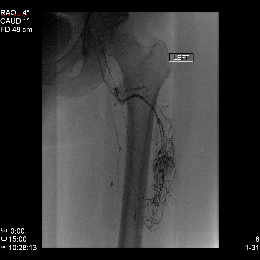 Rochester General Hospital IR tweet media