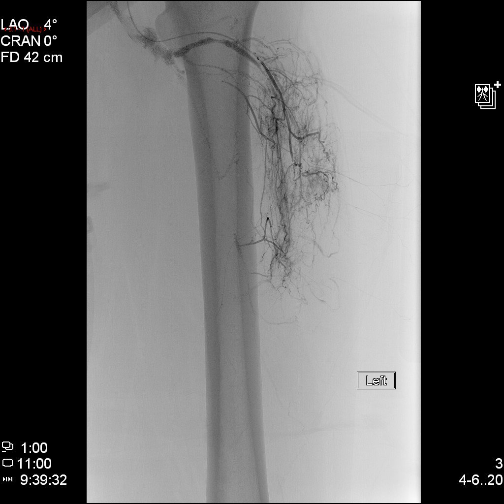Rochester General Hospital IR tweet media