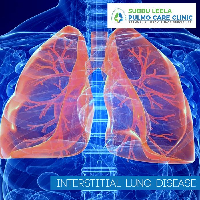 subbuleelapulmo's tweet photo. Interstitial lung disease (ILD) includes a diverse group of respiratory conditions characterized by inflammation and fibrosis of the interstitium. 
Book an Appointment +91-7845501546 
More Visit@ https://t.co/ss5WZgbXjS
#interstitiallungdisease #lungdisease #Asthma #treatment https://t.co/k6uZqiObKh