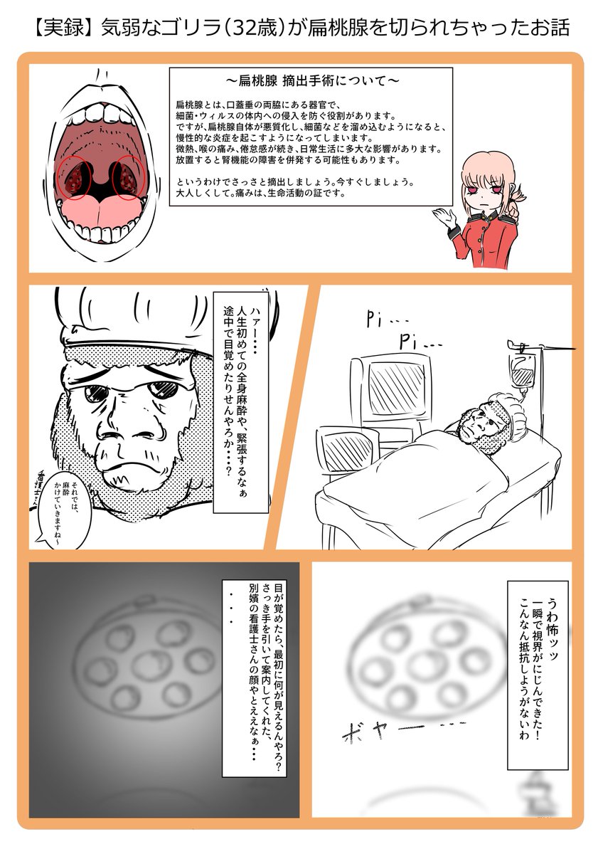 パンプマン ｖ推し絵描き 5日前 生れて初めて全身麻酔手術を受けてきた際の恐怖体験を漫画にしました 術後の傷跡はバカでかい口内炎みたいになっているので 発語や食事に難儀していますが 私は元気です W