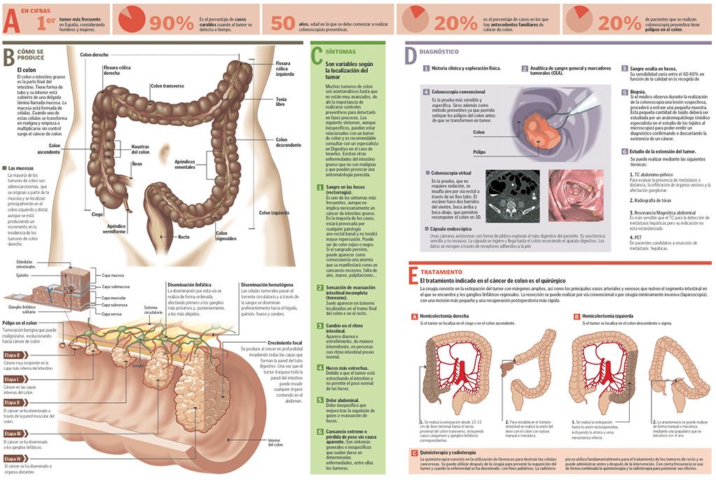 El #CáncerColorrectal es de progresión lenta+80% de los casos presenta una lesión precursora o pólipo, 90% de los #CCR son “adenocarcinomas” y en etapas tempranas existe la posibilidad de curación del 90% a partir de los 50 años, hacete una colonoscopia #MarzoAzul🎗️#FUCA